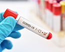 Australia reports record number of Covid cases for 5th straight day